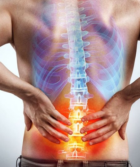 Milyen kiváltó tényezők állhatnak az isiász hátterében?